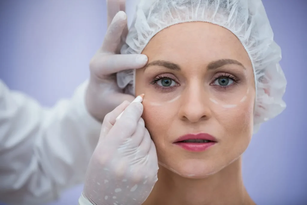 Blefaroplastia: el secreto para rejuvenecer tu mirada Blefaroplastia: el secreto para rejuvenecer tu mirada