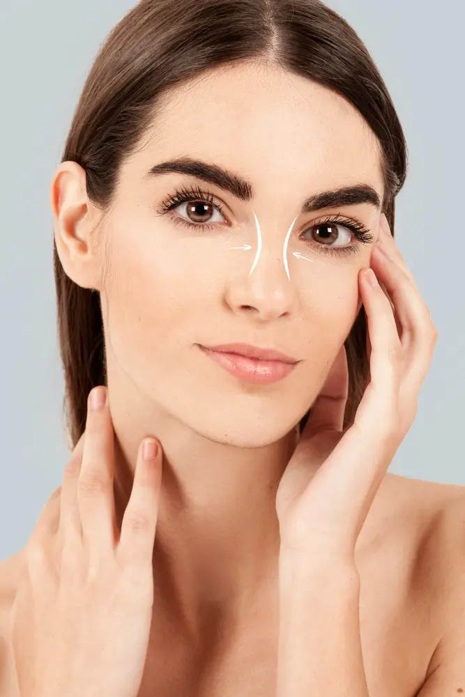 Rinoplastia en cali estética y funcional