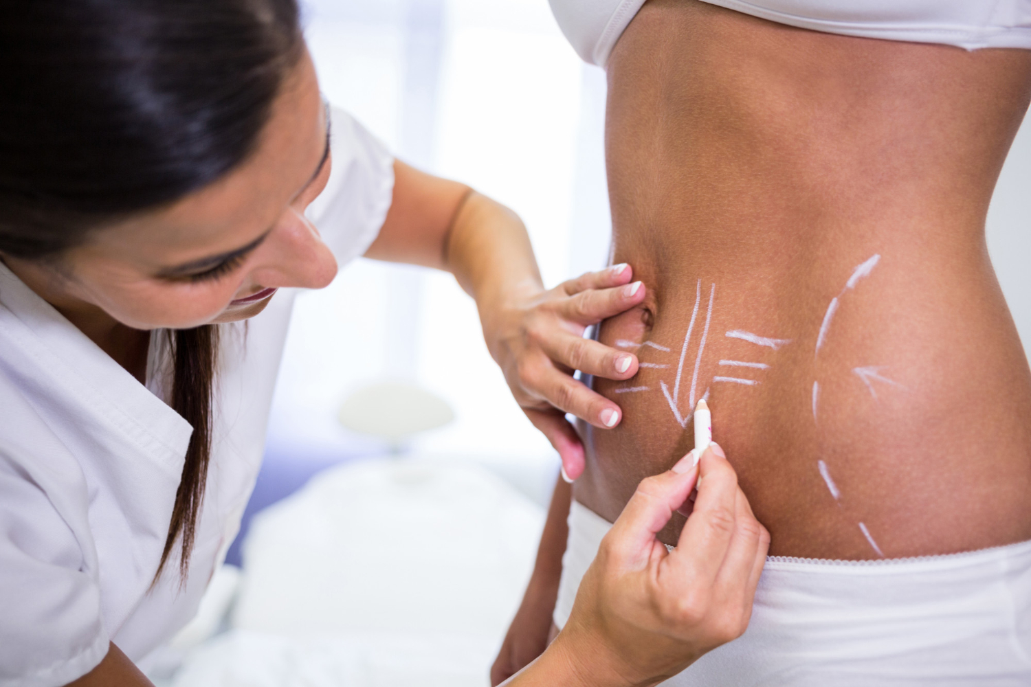 Mommy Makeover cirugía que transforma