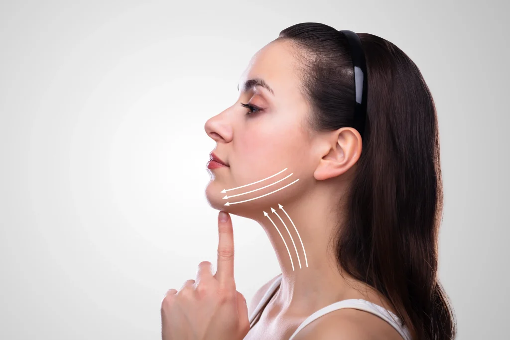 minilifting facial
