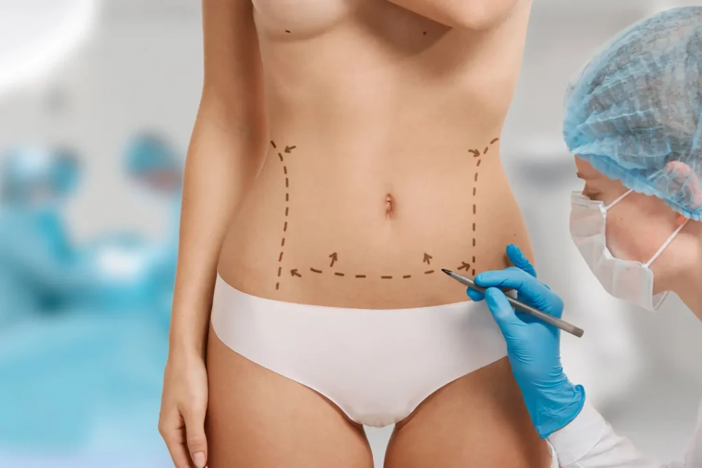 BodyTite: la solución para la flacidez corporal que no quieres operar Body