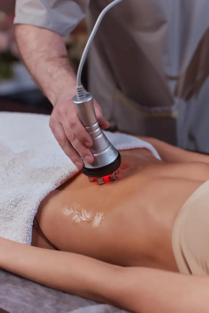 BodyTite: alternativa a la lipoescultura tradicional sin cirugía invasiva