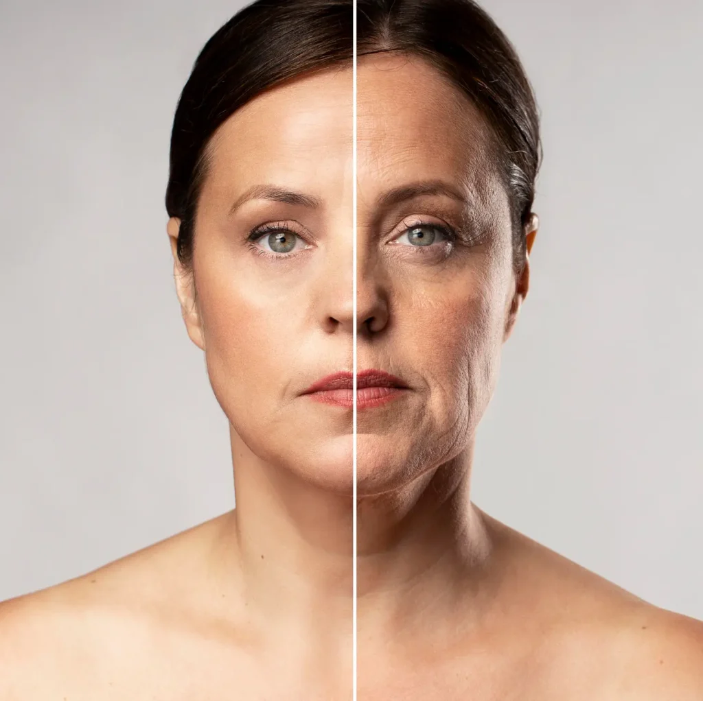 Pros y contras del lifting facial: lo que todo paciente debe saber antes de decidir La Cirugía Endoscópica Facial