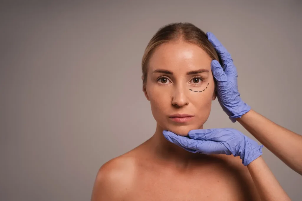 Blefaroplastia transconjuntival: la técnica sin cicatriz visible explicada Resultado de cirugía de párpados caídos en Cali — Dr. Carlos Recio