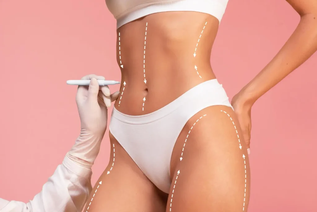 ¿Cuánto vale una liposucción en Colombia? ¿Cuánto vale una liposucción en Colombia?