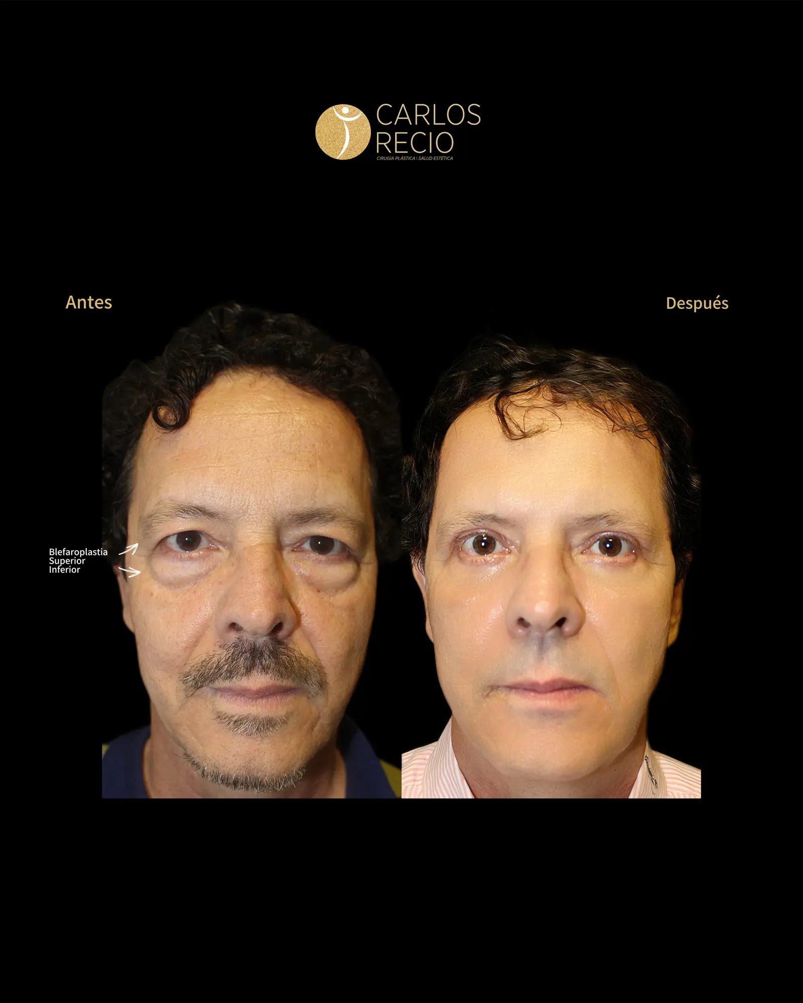 Armonización Facial Quirúrgica en Cali IMG_3398.webp