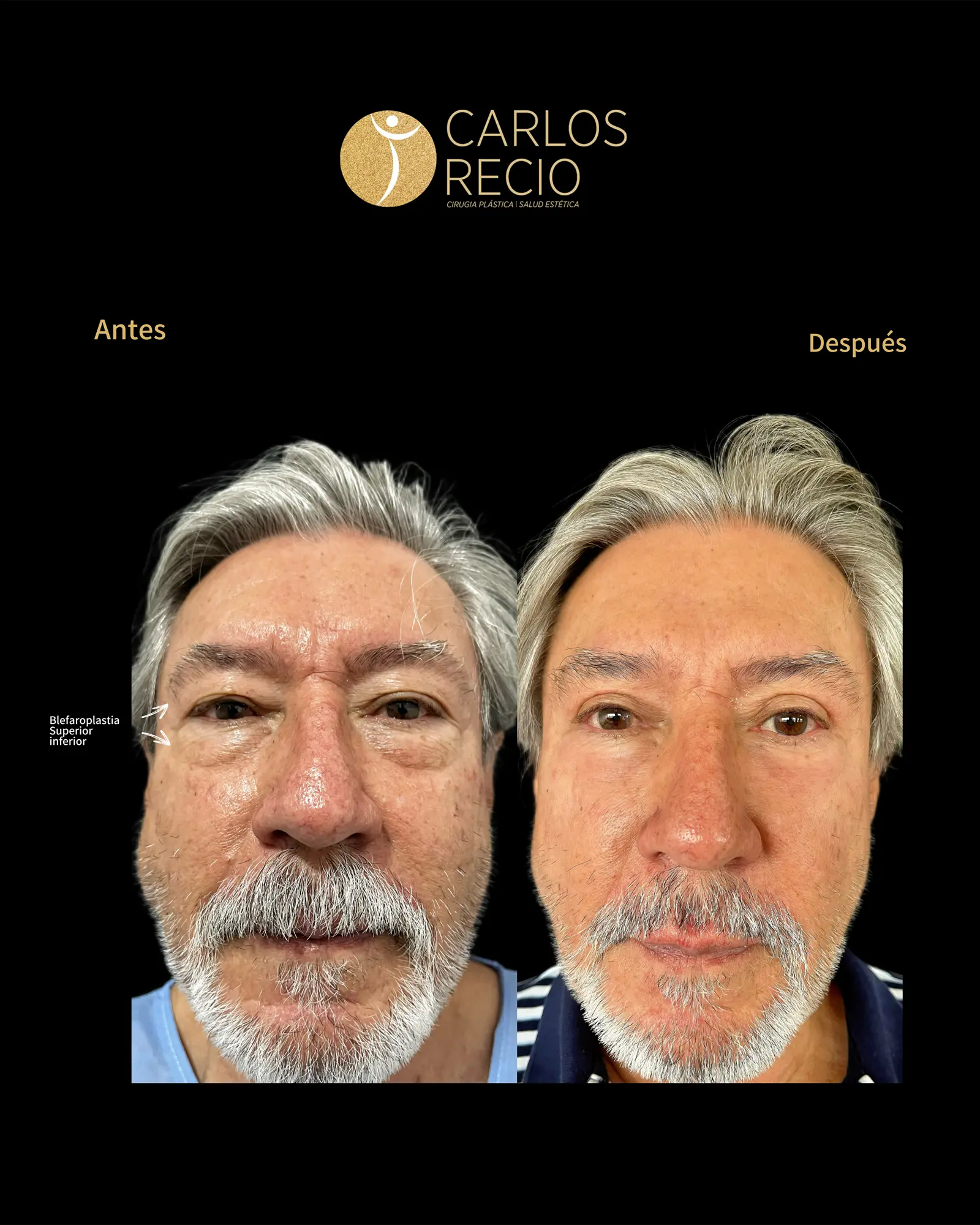 Armonización Facial Quirúrgica en Cali IMG_3399.webp