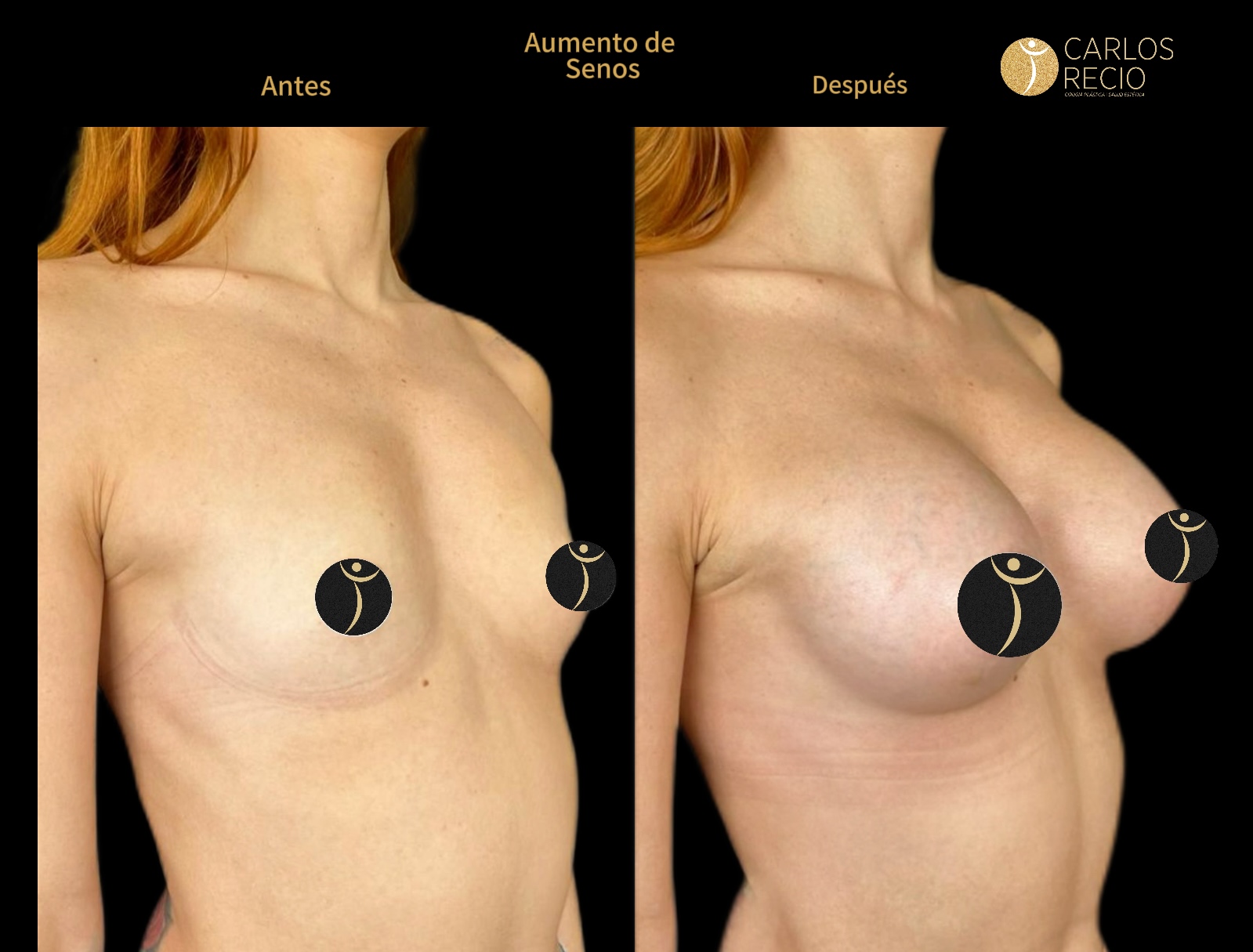 Dr. Carlos Recio Cirujano plástico en Cali Copia de IMG_3594