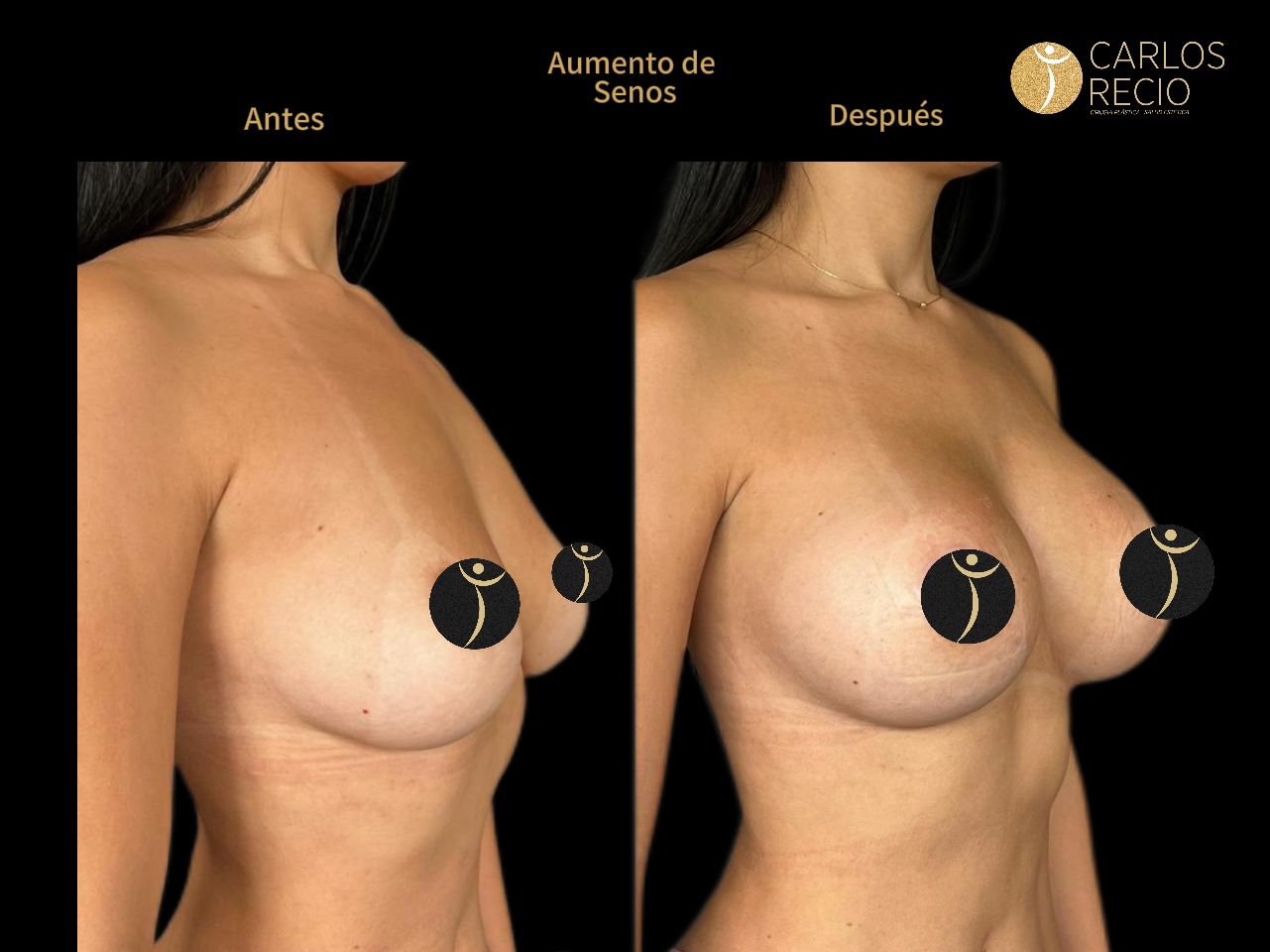 Dr. Carlos Recio Cirujano plástico en Cali Copia de IMG_3596