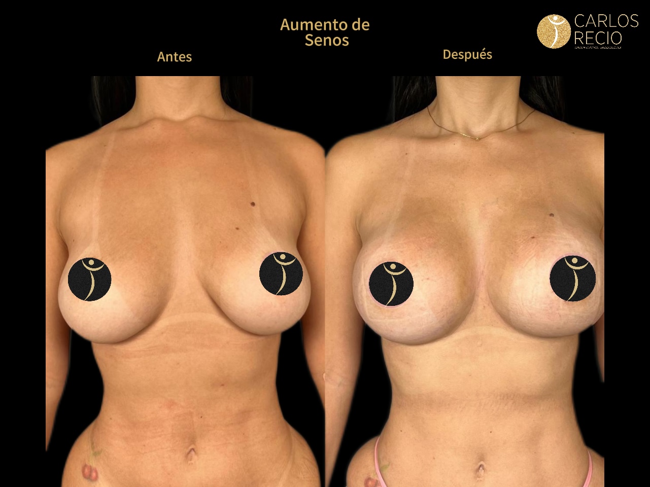 Dr. Carlos Recio Cirujano plástico en Cali Copia de IMG_3598