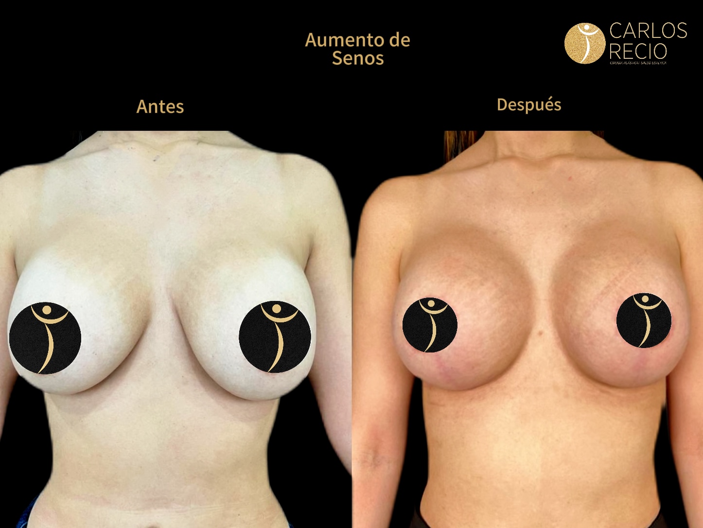 Dr. Carlos Recio Cirujano plástico en Cali Copia de IMG_3606