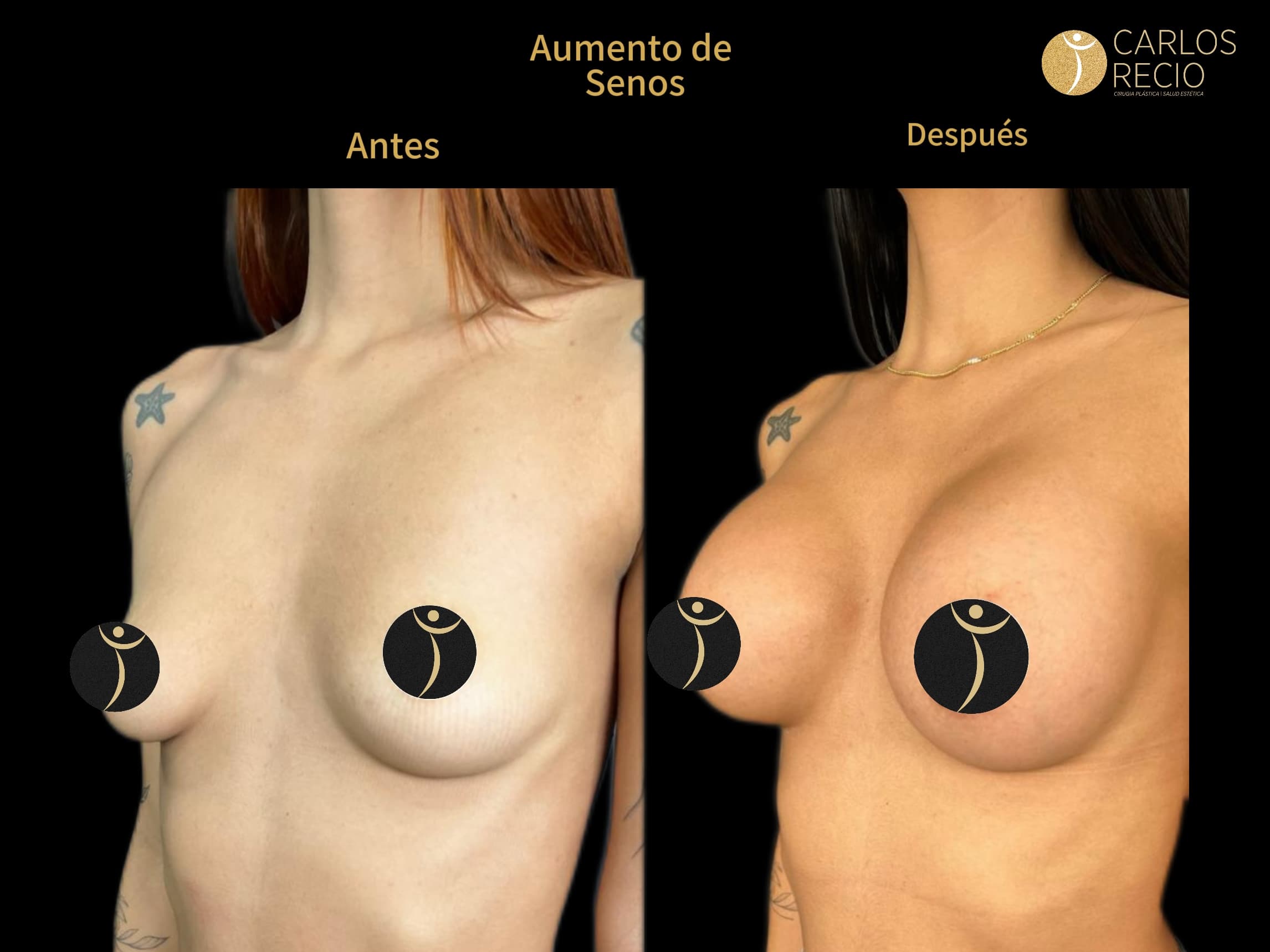 Dr. Carlos Recio Cirujano plástico en Cali Copia de IMG_3610