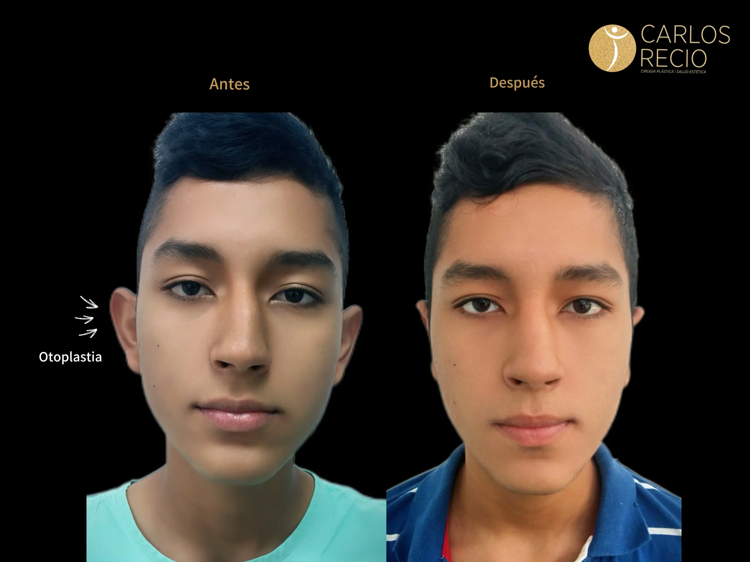 Procedimientos para Hombres en Cali IMG_4868