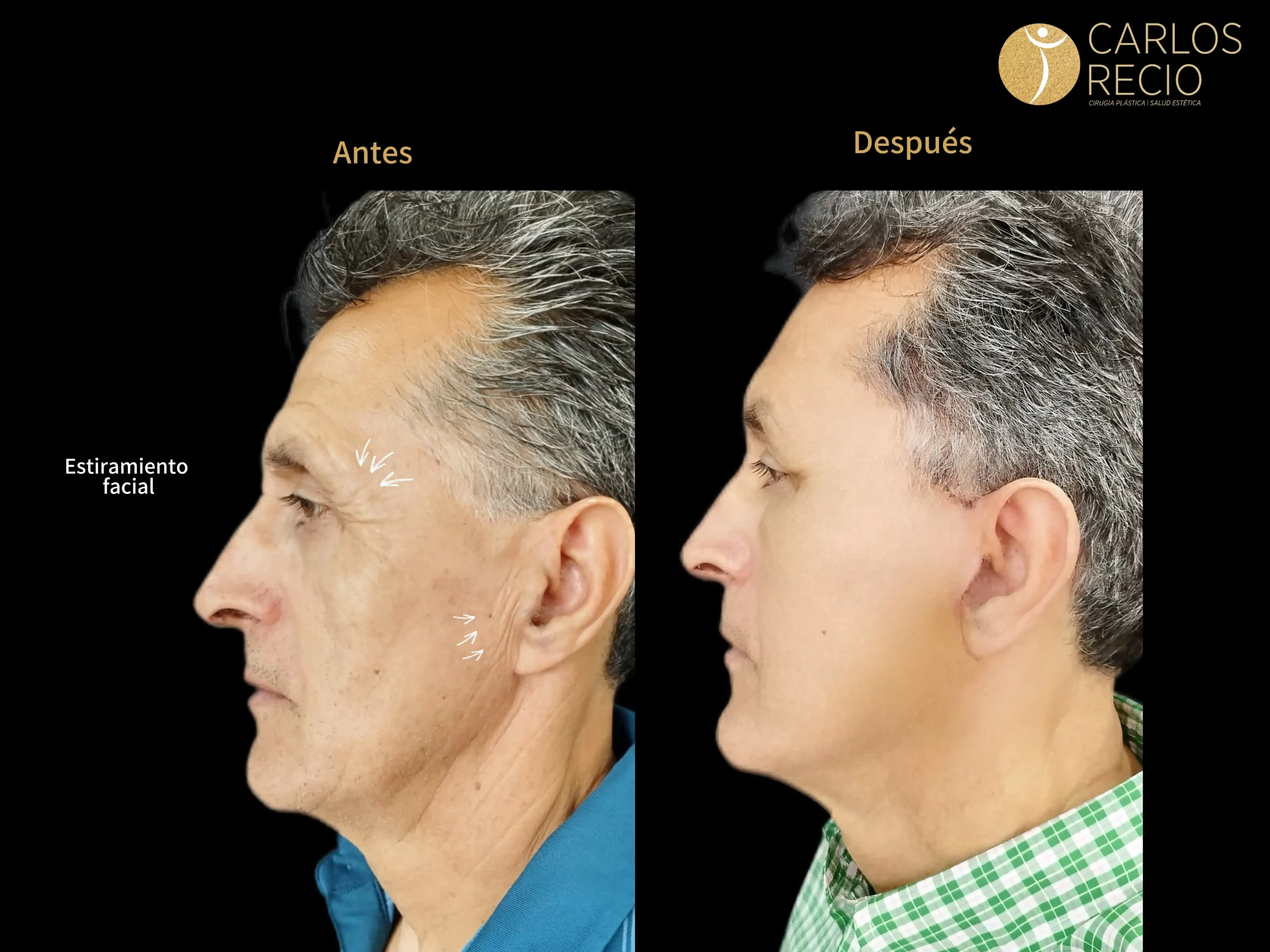 Procedimientos para Hombres en Cali IMG_4917