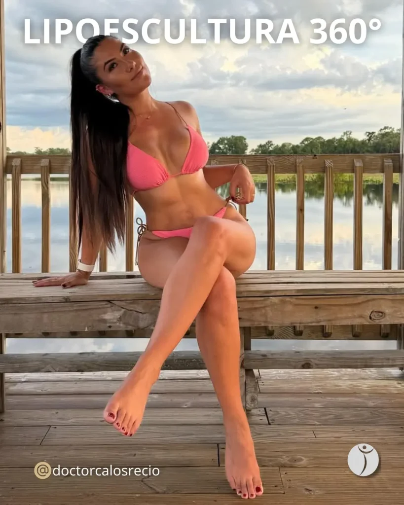 Lipo 360 en Cali: precio, resultados y diferencias con la lipoescultura tradicional Lipo 360