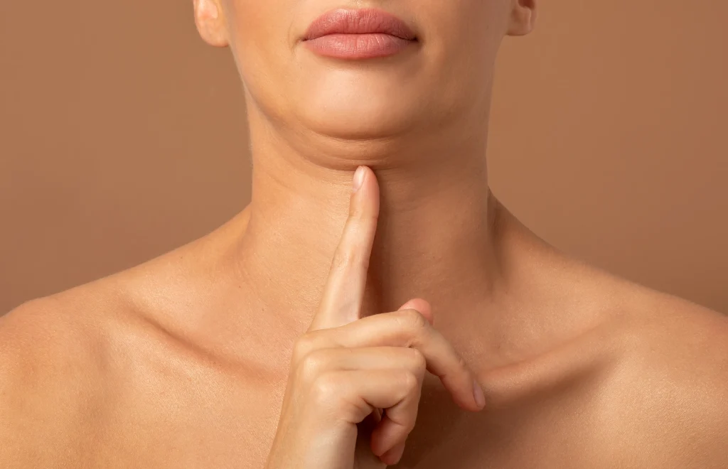 Solución a la papada por flacidez cutánea: Más allá de la liposucción Solución a la papada por flacidez cutánea: Más allá de la liposucción