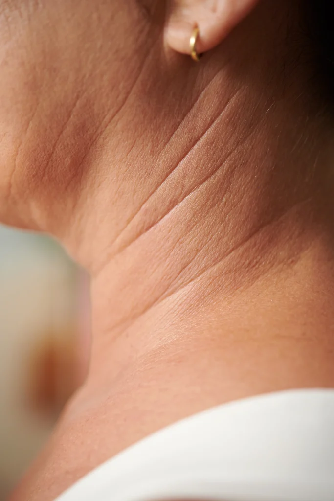 UltraZ: Define Cuello, Papada y Brazos sin Cirugía con Ultrasonido de Precisión UltraZ: Define Cuello, Papada y Brazos sin Cirugía con Ultrasonido de Precisión