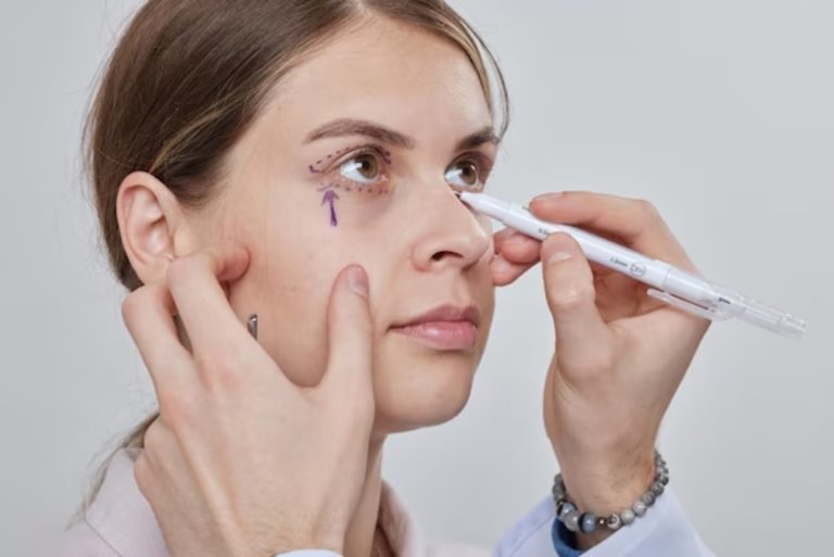 blefaroplastia en Cali